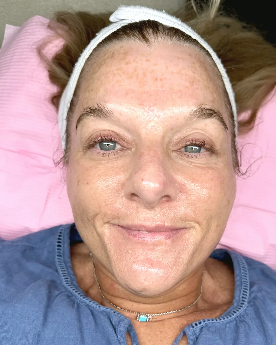 Glowing skin after a Glass Skin Facial at Glow Up Suite