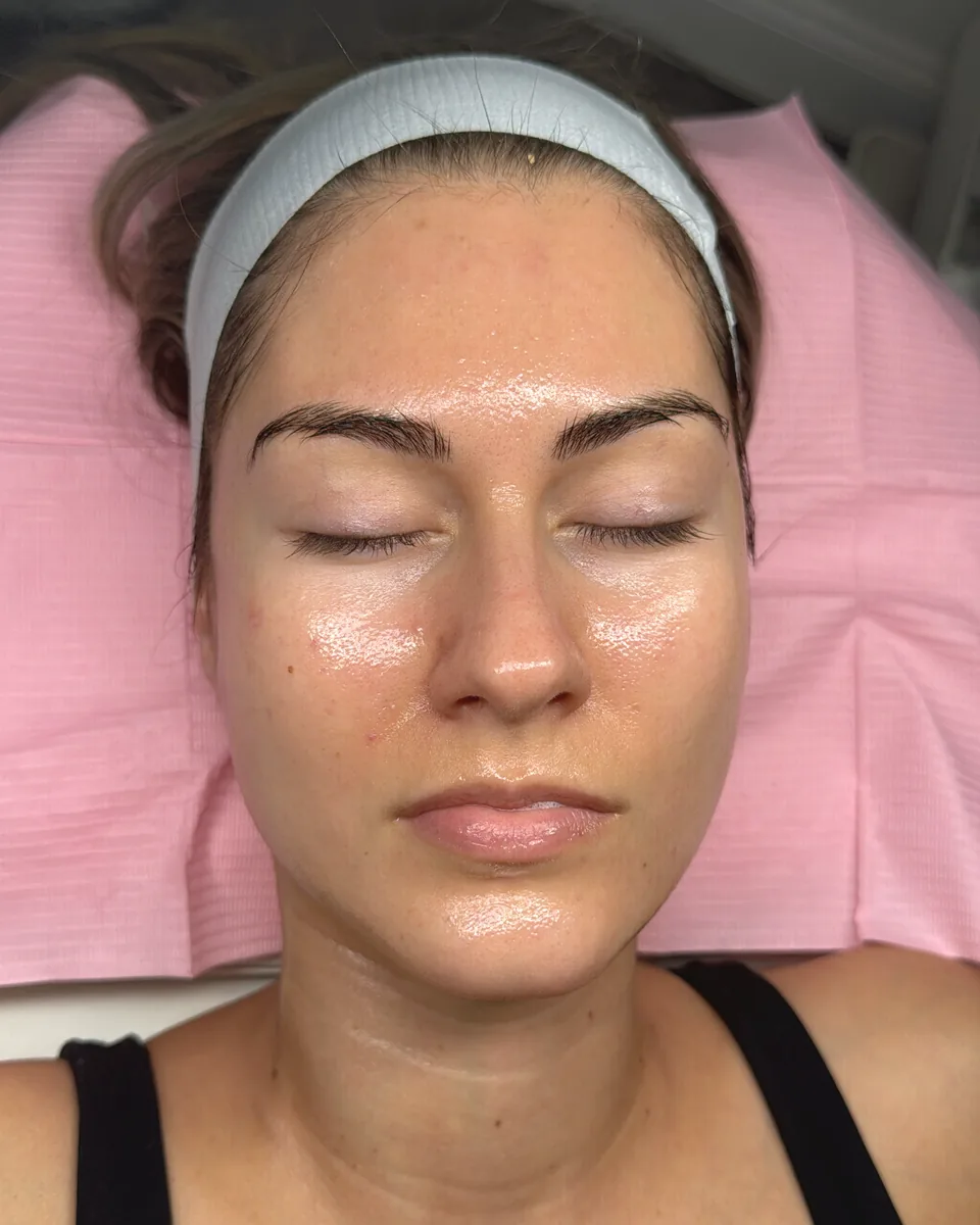 Dewy, glowing skin after a Glow Up Facial at Glow Up Suite
