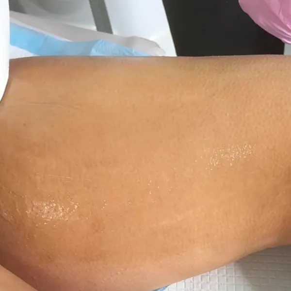 Laser hair removal gel on the leg at Glow Up Suite, latest reel on Instagram