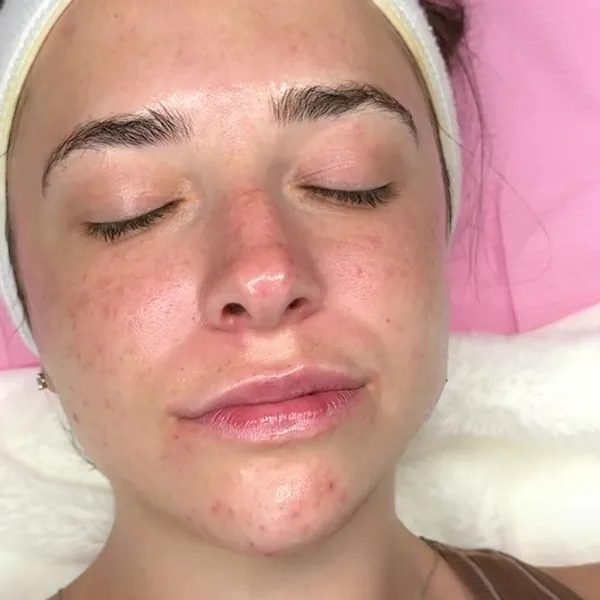 Glowing skin after a Glass Skin Facial at Glow Up Suite, latest reel on Instagram
