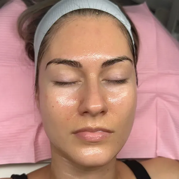 Dewy skin after a Glow Up Facial at Glow Up Suite, on Instagram